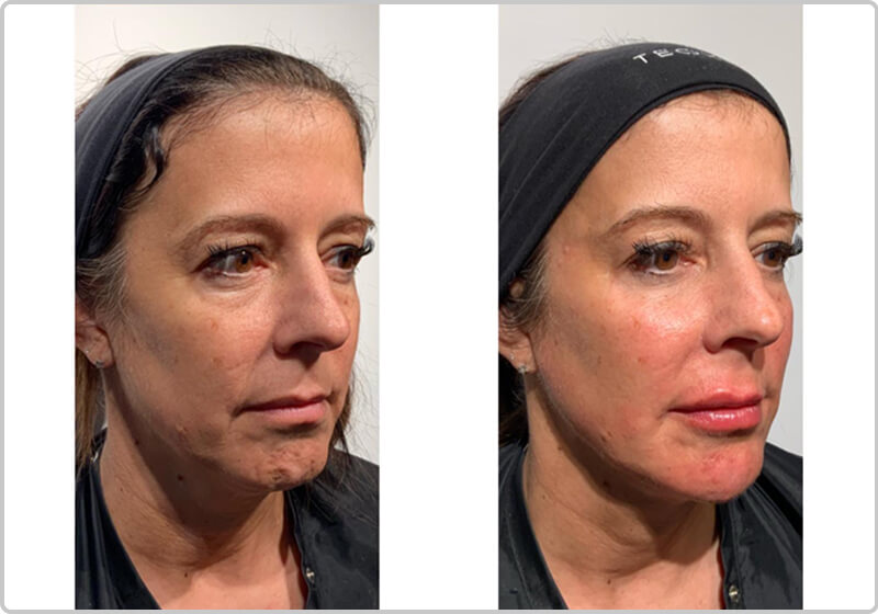 Before and after pictures of a patient